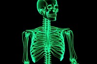 Skeleton green radiography fracture.