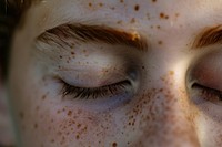 Boy with freckles skin face eye.