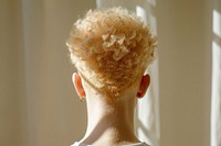 Woman with albinism model skin hairstyle headshot.
