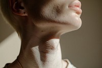 Woman with albinism model skin neck hairstyle.