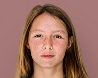 Freckled girl face portrait, natural beauty concept