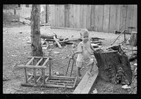 [Untitled photo, possibly related to: Sharecropper's child suffering from rickets and malnutrition, Wilson cotton plantation, Mississippi County, Arkansas]. Sourced from the Library of Congress.