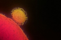 Magnified respiratory syndrome coronavirus