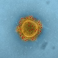 MERS Coronavirus Particle&ndash;Middle East Respiratory Syndrome Coronavirus particle envelope proteins immunolabeled with Rabbit HCoV-EMC/2012 primary antibody and Goat anti-Rabbit 10 nm gold particles.