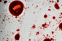 Infectious coronavirus blood splatter 