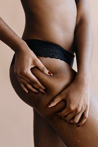 Black woman with a leg skin problem social template