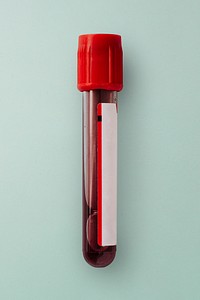 Coronavirus blood test tube