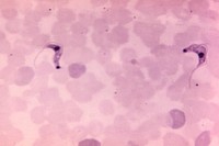 Photomicrograph of a blood smear specimen. Original image sourced from US Government department: Public Health Image Library, <a href="https://www.rawpixel.com/search/cdc?sort=curated&amp;page=1">Centers for Disease Control and Prevention</a>. Under US law this image is copyright free, please credit the government department whenever you can&rdquo;.