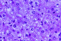 A 440X photomicrograph magnification of a hematoxylin and eosin (H&amp;E)&ndash;stained liver tissue specimen, revealed the presence of cytoarchitectural changes indicative of fatty degeneration.