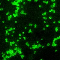 A photomicrograph of a direct fluorescent antibody (DFA)&ndash;stained specimen, revealing the presence of numerous Francisella tularensis coccobacilli.