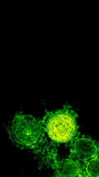 Green coronavirus under a microscope