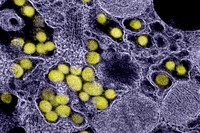Novel Coronavirus SARS-CoV-2 electron micrograph