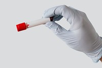 Hand of doctor holding blood tests from covid-19 patient