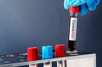 Surgeon holding a coronavirus blood test tube