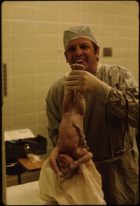 Dr. Milton Kaiser, an Associate of Dr. Howard Vogel and Dr Ann Vogel, Holds a Newborn Baby Soon after Its Caesarean Delivery in Union Hospital in New Ulm, Minnesota.