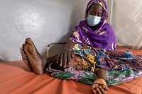 A mother and her child wait to receive treatment for severe malaria. Original public domain image from Flickr