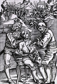 Military surgeon treats battle woundAuthor(s): Gersdorff, Hans von, -1529., author Publication: Strassburg: Joannem Schott, [1517] Language(s): German Format: Still image Subject(s): Wounds and Injuries, Military Medicine Genre(s): Book Illustrations Abstract: A man with an arrow wound sits on a stool while the surgeon removes the arrow; an assistant holds the patient from behind; a battle rages in the background. Related Title(s): Is part of: Feldtbüch der Wundtartzney, Pl. opp. l. xlv.; See related catalog record: 2246019R Extent: 1 print Technique: woodcut NLM Unique ID: 101436200 NLM Image ID: A013208 Permanent Link: resource.nlm.nih.gov/101436200 