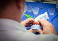 NMCSD Surgeons fit DOD’s, Calif.’s First Ever Immediate Jaw Reconstruction with 3D-printed Teeth Patient with Prosthesis. Original public domain image from Flickr