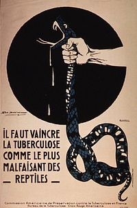 Il faut vaincre la tuberculose comme le plus malfaisant des reptiles =: Tuberculosis must be conquered like the most evil of reptilesCollection:Images from the History of Medicine (IHM) Contributor(s):Dorival, Géo, 1879-Capon, G.Commission américaine de préservation contre la tuberculose en France.American National Red Cross. Tuberculosis Office. Publication:[France?] : Commission américaine de préservation contre la tuberculose en France : Bureau de tuberculose, Croix-Rouge américaine, [1918] Language(s):French Format:Still image Subject(s):Tuberculosis, Pulmonary -- prevention & controlSnakes Genre(s):Posters Abstract:Poster on tan or discolored white paper with black lettering. Visual image is an illustration of a human hand choking a snake. Venom drips from the snake's open mouth. Title in lower left quadrant. Publisher information at bottom of poster.  Extent:1 print (poster) : 119 x 78 cm. Technique:lithograph, color NLM Unique ID:101439371 NLM Image ID:A026623 Permanent Link:resource.nlm.nih.gov/101439371 