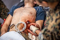 U.S. Marine Corps Forces, South puts the Tactical Scalable Surgical System to the Test. Original public domain image from Flickr