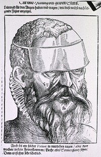 Man Wearing an EyeshadeCollection:Images from the History of Medicine (IHM) Author(s):Bartisch, George, 1535-approximately 1607, author Publication:[Dreszden: Matthes Stöckel], 1583 Language(s):German Format:Still image Subject(s):Ophthalmology,Eye Protective Devices,Cataract Genre(s):Book Illustrations Abstract:Close-up of the face of a man wearing an eyeshade as treatment for yellow cataract. Related Title(s):Is part of: Ophthalmodouleia, das ist, Augendienst, l. 73 recto.; See related catalog record: 2221062R Extent:1 print Technique:woodcut NLM Unique ID:101436441 NLM Image ID:A016271 Permanent Link:resource.nlm.nih.gov/101436441