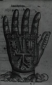 Artificial HandCollection:Images from the History of Medicine (IHM) Author(s):Paré, Ambroise, 1510?-1590 Publication:[Paris:] : Jean Le Royer, 1564 Language(s):French Format:Still image Subject(s):Hand, Artificial Limbs Genre(s):Book Illustrations Abstract:Hand with mechanical apparatus. Related Title(s):Is part of: Dix livres de la chirurgie, p. 121.; See related catalog record: 2274012R Extent:1 print Technique:woodcut NLM Unique ID: 101448278 NLM Image ID: A030580 Permanent Link:resource.nlm.nih.gov/101448278