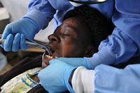 Lilongwe, Malawi – An Air Force Reservist perform a tooth extraction of a Malawian patient suffering from tooth pain. For some of the Malawian patients it was the first time they had ever received dental care. MEDREACH is a key program in the United States’ efforts to partner with the Government of Malawi. (Photo by Sgt. Jesse Houk, 139th MPAD, Illinois Army National Guard). Original public domain image from Flickr