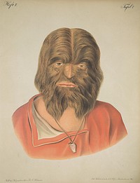 Hairy-faced man. Image of a lithograph from Hebra's Atlas, pt. 10, pl. 7, showing a man in red shirt whose face is completely covered in brown hair.Original public domain image from Flickr