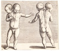 A deformed child with two heads by Hendrick Goltzius