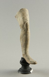 Left Leg Broken at Mid-Thigh by Ancient Greek