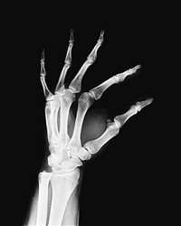 Hand X-Ray collage element psd