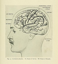 Identifier: textbookofclinic00eise (find matches)Title: A text-book of clinical anatomy : for students and practitionersYear: 1907 (1900s)Authors: Eisendrath, Daniel N. (Daniel Nathan), b. 1867Subjects: Human anatomy AnatomyPublisher: Philadelphia London : W.B. Saunders CompanyContributing Library: Francis A. Countway Library of MedicineDigitizing Sponsor: Open Knowledge Commons and Harvard Medical SchoolView Book Page: Book ViewerAbout This Book: Catalog EntryView All Images: All Images From BookClick here to view book online to see this illustration in context in a browseable online version of this book.Text Appearing Before Image:tionsof brain, and of middle meningeal artery to skull. M.A., Anterior or ascending branch ofthe middle meningeal artery. M.P., Posterior or horizontal branch of the middle menin-geal artery. These two join so that the main trunk lies about opposite the middle of thezygoma. F.R., Fissure of Rolando, lying between 4, the ascending frontal, and 5, theascending parietal convolution. F.S., Fissure of Sylvius, that is, the horizontal limb. 1,2, and 3, First, second, and third frontal convolution. 6, Parietal lobe. 7, Occipital lobe.8, 9, and 10, First, second, and third temporal convolution. L.S., Lateral sinus. Thedotted line shows that portion of the lateral sinus which descends on the inner side of themastoid process (sigmoid sinus). The remainder of the lateral sinus is shown passingsomewhat horizontally backward beneath the occipital lobe (7). A.M., Projection ofmastoid antrum, on surface. 5i ,PRAECENTRAL GYRUS.POSTCENTRALFR y GYRUS WJ5UEPAR,; SUP. FRONTAL i MID.FRONTAL. INF. FRONT. -Text Appearing After Image:OCCIPITALLOBE Fig. 15.--Cerebral localization. SF, Fissure of Sylvius. RF, Fissure of Rolando. 53Note About ImagesPlease note that these images are extracted from scanned page images that may have been digitally enhanced for readability - coloration and appearance of these illustrations may not perfectly resemble the original work.