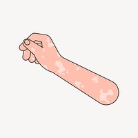 Vitiligo hand arm, gesture flat collage element vector