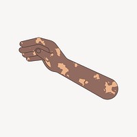 Black vitiligo hand arm, gesture flat illustration