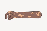 Black vitiligo hand arm, gesture flat collage element vector