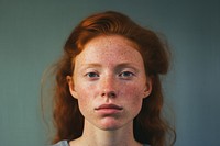 Portrait freckle adult woman. 