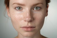 Skin portrait freckle women. 