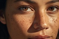 Freckle skin adult woman. 