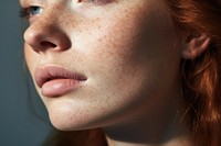 Skin freckle adult woman. 