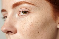 Freckle adult woman skin. 