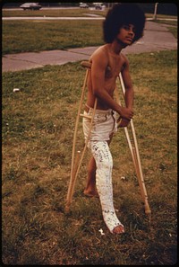 Young Man with His Leg in a Cast in Hiland Park of Brooklyn New York City. The Inner City Today Is an Absolute Contradiction to the Main Stream America of Gas Stations, Expressways, Shopping Centers and Tract Homes.