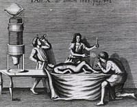 Figure using microscope. Figure using the author's microscope (with help of attendant) to examine leg wound. (Probably the first illustration of clinical microscopy). Original public domain image from Flickr
