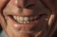 Smiling teeth person smile skin. 