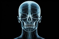 Brain human radiography tomography. 