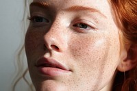 Freckles skin adult woman. 