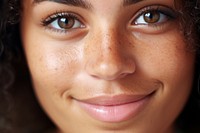 Freckle smiling skin face. 