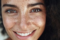 Freckle smiling adult woman. 