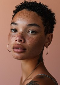 Vitiligo portrait freckle adult. 