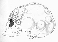 Anatomie et physiologie du système nerveux en général, et du cerveau en particulier, avec des observations sur la possibilité de reconnoître plusieurs dispositions intellectuelles et morales de l'homme et des animaux par la configuration de leurs têtes / Par F. J. Gall et G. Spurzheim.
