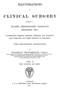 Illustrations of clinical surgery : consisting of plates, photographs, woodcuts, diagrams, etc. illustrating surgical diseases, symptoms and accidents also operative and other methods of treatment / with descriptive letterpress by Jonathan Hutchinson.